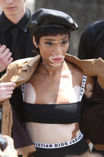 Full leaked Winnie harlow private onlyfans photo